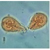 giardia