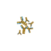 antibody-ebv