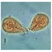 giardia